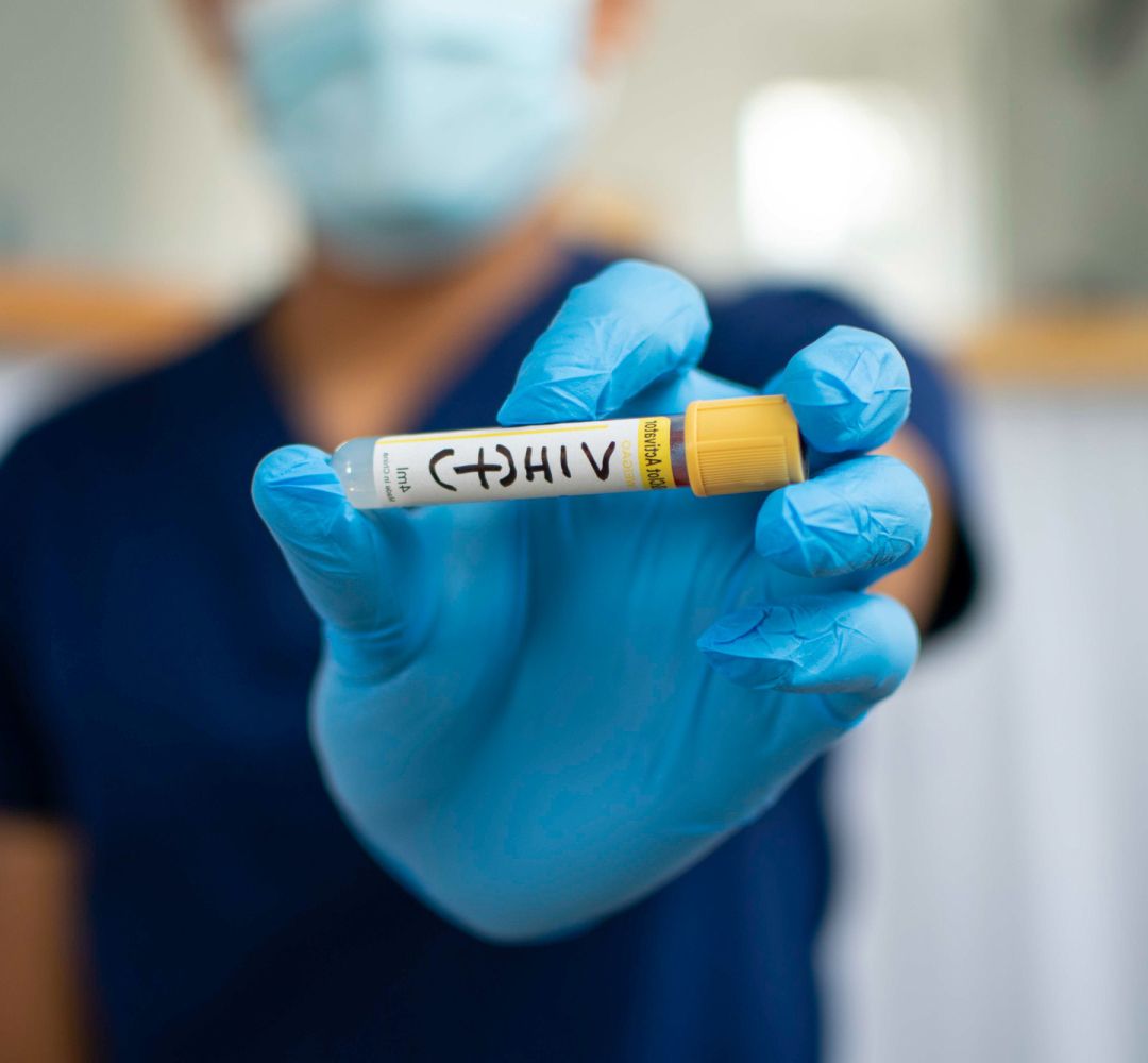 ترس از اچ‌آی‌وی ناشی از انگ اجتماعی