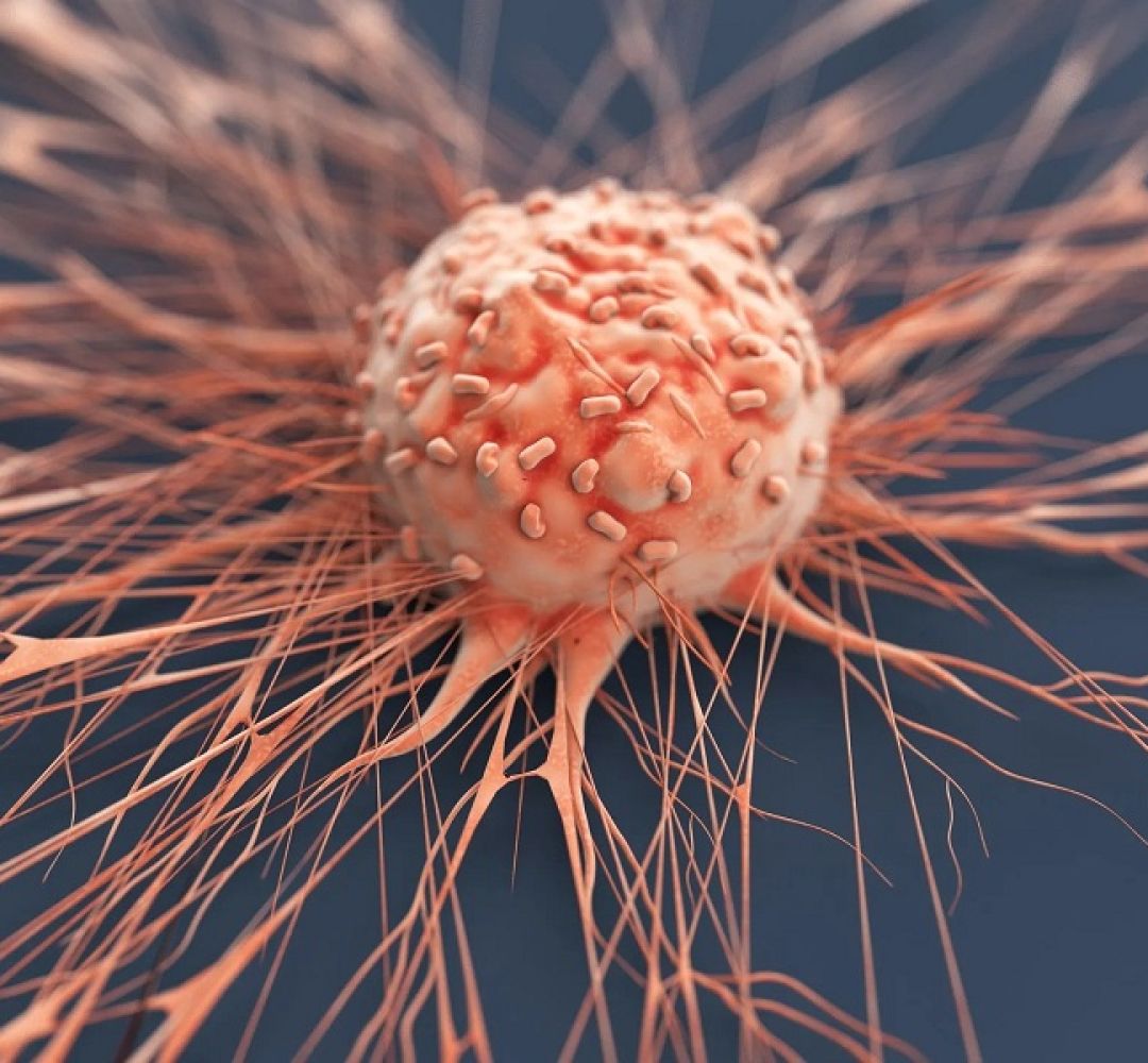 اصلاح سبک زندگی لازمه پیشگیری از سرطان